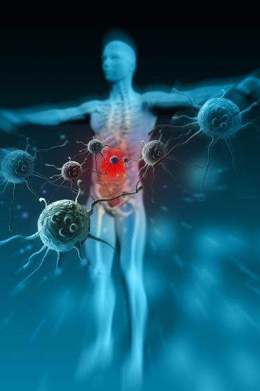Antientzündliche Low Carb Ernährung bei Autoimmunerkrankungen